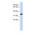 Western Blot: ACTRT1 Antibody [NBP1-56370] - This Anti-ACTRT1 antibody was used in Western Blot of Fetal Pancreas   tissue lysate at a concentration of 1ug/ml.
